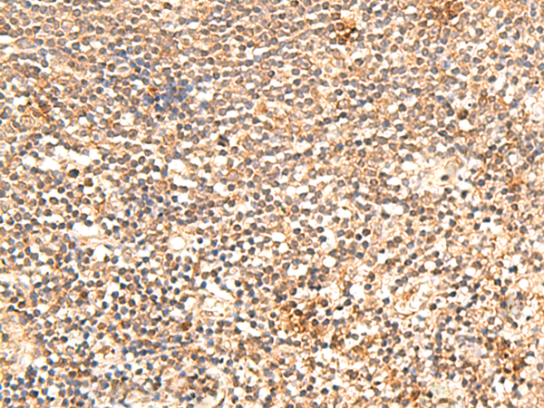 Surface staining of CD18 in human peripheral blood with anti-CD18 (MEM-148) APC.