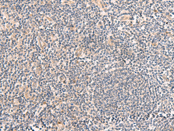 Immunohistochemistry of paraffin-embedded Human tonsil tissue using TA366207 (TEAD3 Antibody) at dilution 1/50 (Original magnification: x200)