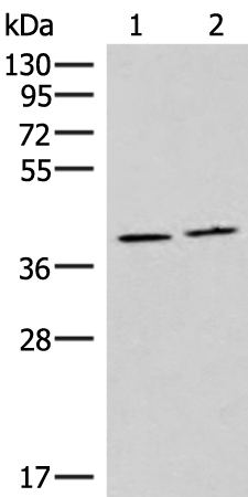 Gel: 8%SDS-PAGE Lysate: 40 microg Lane 1-2: Human placenta tissue and Human fetal brain tissue lysates Primary antibody: TA366221 (HMGCLL1 Antibody) at dilution 1/1000 Secondary antibody: Goat anti rabbit IgG at 1/5000 dilution Exposure time: 40 seconds