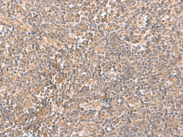 Immunohistochemistry of paraffin-embedded Human tonsil tissue using TA366225 (TRUB1 Antibody) at dilution 1/70 (Original magnification: x200)