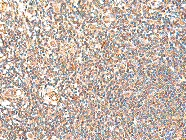 Immunohistochemistry of paraffin-embedded Human tonsil tissue using TA366226 (GPD1L Antibody) at dilution 1/60 (Original magnification: x200)