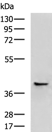 Surface staining of human peripheral blood with anti-human CD31 (MEM-05) APC.