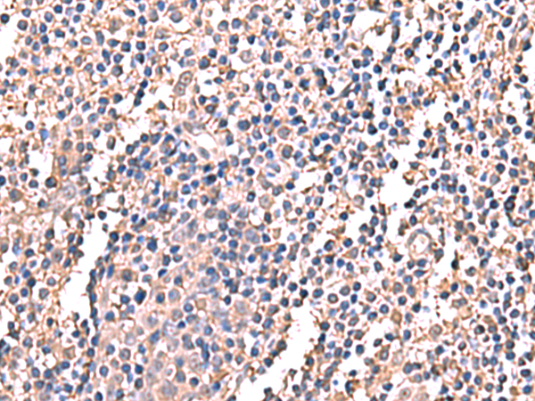 Human Tonsil, Frozen Section stained with CD120b antibody clone Utr1