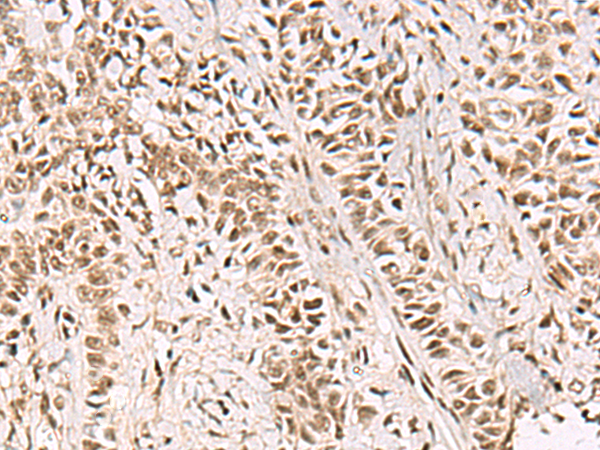 Immunohistochemistry on frozen sections on Human placenta with Clone 1F10