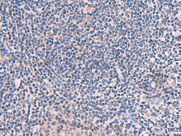 Confocal microscopy of human HeLa cells using anti-p53 (BP53-12; FITC). The expression of p53 protein was enhanced by intercalating reagent. Cells were fixed and permeabilized before incubation with the p53-FITC MAb.