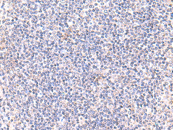 Immunohistochemical staining of Rat Lung Frozen Section uing antibody Clone IIE11.