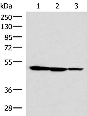 Gel: 8%SDS-PAGE Lysate: 40 microg Lane 1-3: HepG2 K562 and A172 cell lysates Primary antibody: TA366293 (TTC38 Antibody) at dilution 1/1000 Secondary antibody: Goat anti rabbit IgG at 1/5000 dilution Exposure time: 25 seconds