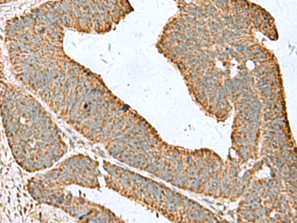 Figure 1. AIF1 antibody staining of Human Spleen Paraffin Section.