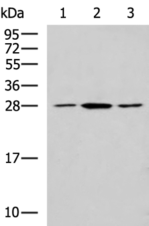 Gel: 12%SDS-PAGE Lysate: 40 microg Lane 1-3: NIH/3T3 LO2 and Jurkat cell lysates Primary antibody: TA366419 (CLTB Antibody) at dilution 1/800 Secondary antibody: Goat anti rabbit IgG at 1/5000 dilution Exposure time: 25 seconds