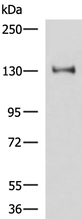Gel: 6%SDS-PAGE Lysate: 40 microg Lane: Hela cell lysate Primary antibody: TA366425 (PRPF40A Antibody) at dilution 1/800 Secondary antibody: Goat anti rabbit IgG at 1/5000 dilution Exposure time: 5 minutes