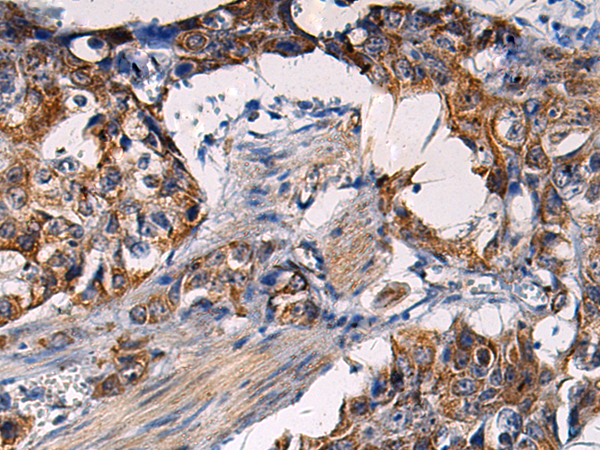 Immunohistochemistry on paraffin section of human liver.