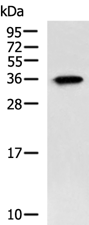Gel: 12%SDS-PAGE Lysate: 40 microg Lane: 293T cell lysate Primary antibody: TA366474 (SPACA1 Antibody) at dilution 1/1000 Secondary antibody: Goat anti rabbit IgG at 1/5000 dilution Exposure time: 1 minute