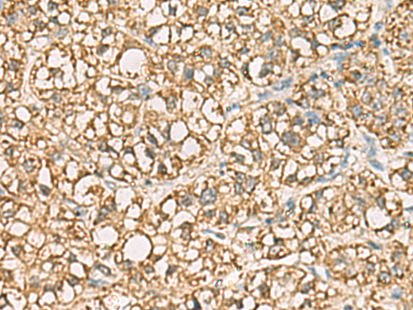 Frozen Section of Swine colon immunostained with RV202-HRP Vimentin Antibody Cat.-No BM6008HRP (1/200).
