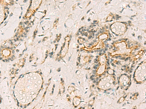 Immunohistochemistry on Frozen section of swine colon using Vimentin Antibody showing positive staining in connective tissue cells and no reactivity in epithelial cells.