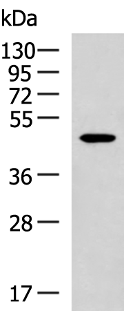 Immunofluorescence staining of a 7 days old Zebrafish embryo.