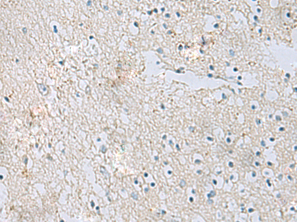 Immunohistochemistry of paraffin-embedded Human brain tissue using TA366489 (RDH5 Antibody) at dilution 1/50 (Original magnification: x200)