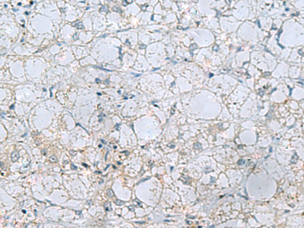 Immunostaining of E-Selectin transfected Chinese Hamster Ovary (CHO) cell.