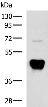 Gel: 8%SDS-PAGE Lysate: 40 microg Lane: SKOV3 cell lysate Primary antibody: TA366523 (POC1A Antibody) at dilution 1/700 Secondary antibody: Goat anti rabbit IgG at 1/5000 dilution Exposure time: 2 minutes