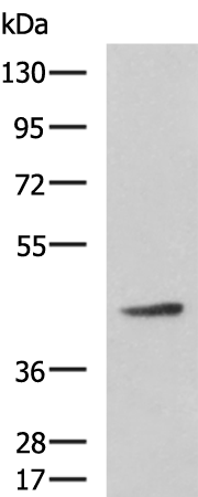 Gel: 8%SDS-PAGE Lysate: 40 microg Lane: Hela cell lysate Primary antibody: TA366528 (ARPC1B Antibody) at dilution 1/800 Secondary antibody: Goat anti rabbit IgG at 1/5000 dilution Exposure time: 3 minutes