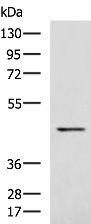 Use of anti-alpha-tub ulin antibody TU-01 as a loading control (A) in an Western blotting experiment revealing the staining pattern of various cell lysates by a newly developed monoclonal antibody (B).