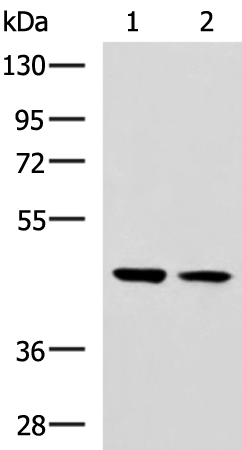 Gel: 8%SDS-PAGE Lysate: 40 microg Lane 1-2: 293T LO2 cell lysates Primary antibody: TA366638 (GLT8D1 Antibody) at dilution 1/800 Secondary antibody: Goat anti rabbit IgG at 1/5000 dilution Exposure time: 20 seconds