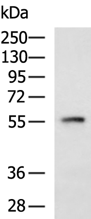 Gel: 8%SDS-PAGE Lysate: 40 microg Lane: Mouse lung tissue lysate Primary antibody: TA366654 (CORO2B Antibody) at dilution 1/1100 Secondary antibody: Goat anti rabbit IgG at 1/5000 dilution Exposure time: 1 minute