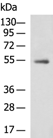 Gel: 8%SDS-PAGE Lysate: 40 microg Lane: Human breast tissue lysate Primary antibody: TA366657 (ZNF639 Antibody) at dilution 1/300 Secondary antibody: Goat anti rabbit IgG at 1/5000 dilution Exposure time: 2 minutes