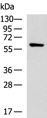 Gel: 8%SDS-PAGE Lysate: 40 microg Lane: Hela cell lysate Primary antibody: TA366660 (PCYOX1 Antibody) at dilution 1/600 Secondary antibody: Goat anti rabbit IgG at 1/5000 dilution Exposure time: 1 minute