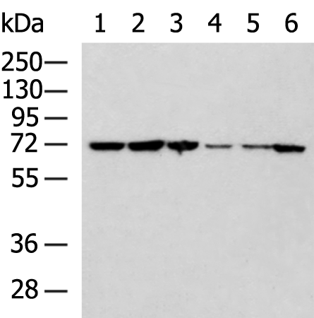 Gel: 8%SDS-PAGE Lysate: 40 microg Lane 1-6: K562 231 Hela HepG2 A172 293T cell lysates Primary antibody: TA366667 (NOP58 Antibody) at dilution 1/600 Secondary antibody: Goat anti rabbit IgG at 1/5000 dilution Exposure time: 3 seconds