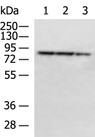 Western blot analysis of extracts (35 ug) from 9 different cell lines by using anti-KRT18 monoclonal antibody.