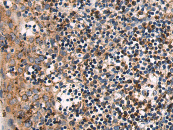Immunohistochemistry of paraffin-embedded Human tonsil tissue using TA366713 (COPB2 Antibody) at dilution 1/60 (Original magnification: x200)