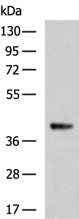 Gel: 8%SDS-PAGE Lysate: 40 microg Lane: Mouse brain tissue lysate Primary antibody: TA366732 (SS18L1 Antibody) at dilution 1/550 Secondary antibody: Goat anti rabbit IgG at 1/5000 dilution Exposure time: 7 seconds