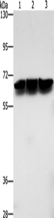 Gel: 8%SDS-PAGE Lysate: 40 microg Lane 1-3: Jurkat cells hela cells mouse brain tissue Primary antibody: TA366755 (ZBTB1 Antibody) at dilution 1/500 Secondary antibody: Goat anti rabbit IgG at 1/8000 dilution Exposure time: 5 seconds