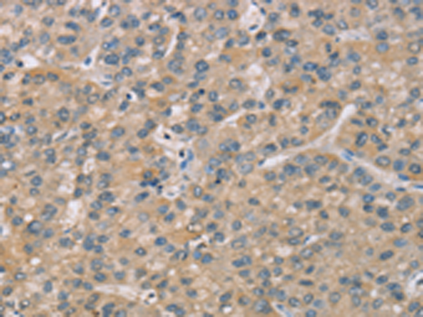 HEK293T cells were transfected with the pCMV6-ENTRY control (Left lane) or pCMV6-ENTRY FOXA1 (RC206045, Right lane) cDNA for 48 hrs and lysed. Equivalent amounts of cell lysates (5 ug per lane) were separated by SDS-PAGE and immunoblotted with anti-FOXA1. Positive lysates LY401427 (100 ug) and LC401427 (20 ug) can be purchased separately from OriGene.