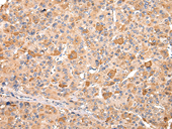 Anti-TYRO3 mouse monoclonal antibody (TA500415) immunofluorescent staining of COS7 cells transiently transfected by pCMV6-ENTRY TYRO3 (RC208260).