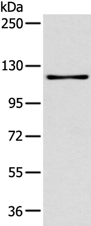 Gel: 6%SDS-PAGE Lysate: 40 microg Lane: K562 cell Primary antibody: TA366909 (ARHGAP4 Antibody) at dilution 1/400 Secondary antibody: Goat anti rabbit IgG at 1/8000 dilution Exposure time: 2 minutes