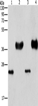 Gel: 10%SDS-PAGE Lysate: 40 microg Lane 1-4: Mouse liver tissue k562 cells hela cells 293T cells Primary antibody: TA366916 (LIN28B Antibody) at dilution 1/550 Secondary antibody: Goat anti rabbit IgG at 1/8000 dilution Exposure time: 1 minute
