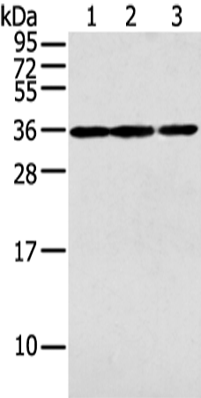 Gel: 12%SDS-PAGE Lysate: 40 microg Lane 1-3: 231 cell mouse brain tissue and A549 cell Primary antibody: TA366918 (PITX3 Antibody) at dilution 1/200 Secondary antibody: Goat anti rabbit IgG at 1/8000 dilution Exposure time: 40 seconds