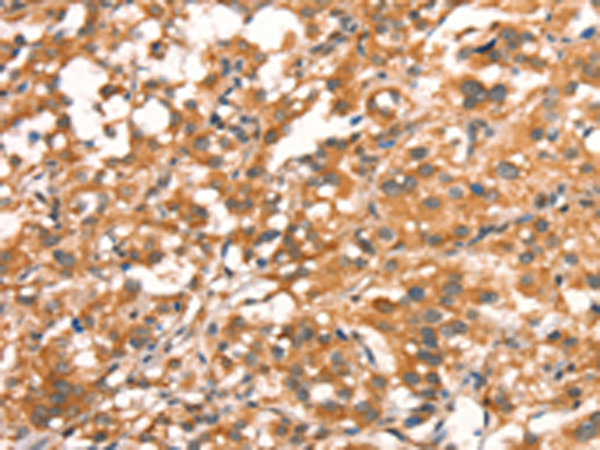 Anti-CRYAB mouse monoclonal antibody (TA500590) immunofluorescent staining of COS7 cells transiently transfected by pCMV6-ENTRY CRYAB (RC202718).