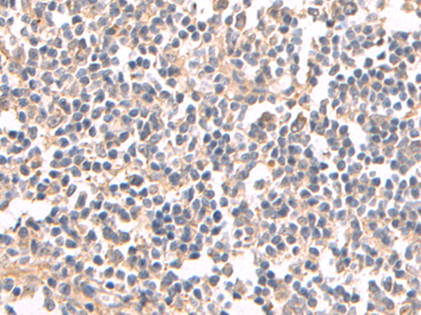 Immunohistochemistry of paraffin-embedded Human tonsil tissue using TA367069 (HCAR2 Antibody) at dilution 1/50 (Original magnification: x200)