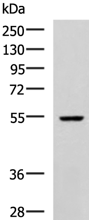 Gel: 8%SDS-PAGE Lysate: 40 microg Lane: A375 cell lysate Primary antibody: TA367137 (MMP23B Antibody) at dilution 1/1000 Secondary antibody: Goat anti rabbit IgG at 1/5000 dilution Exposure time: 10 minutes