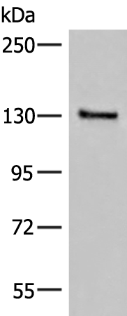 Gel: 6%SDS-PAGE Lysate: 40 microg Lane: Human urinary bladder tissue lysate Primary antibody: TA367234 (SASH1 Antibody) at dilution 1/300 Secondary antibody: Goat anti rabbit IgG at 1/8000 dilution Exposure time: 20 seconds