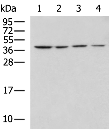 Gel: 12%SDS-PAGE Lysate: 40 microg Lane 1-4: TM4 cell HepG2 cell Mouse testis tissue Jurkat cell lysates Primary antibody: TA367239 (SYCP3 Antibody) at dilution 1/800 Secondary antibody: Goat anti rabbit IgG at 1/5000 dilution Exposure time: 90 seconds