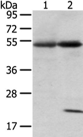 Gel: 8%SDS-PAGE Lysate: 80 microg Lane 1-2: Human lung cancer and placenta tissue Primary antibody: TA367302 (SNTA1 Antibody) at dilution 1/200 Secondary antibody: Goat anti rabbit IgG at 1/8000 dilution Exposure time: 1 minute