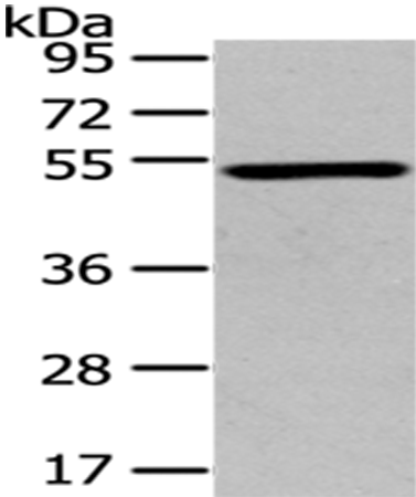 Gel: 8%SDS-PAGE Lysate: 40 microg Lane: Mouse brain tissue Primary antibody: TA367337 (TSPYL1 Antibody) at dilution 1/200 Secondary antibody: Goat anti rabbit IgG at 1/8000 dilution Exposure time: 2 minutes