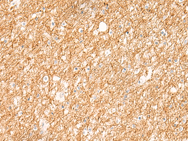 Immunohistochemistry of paraffin-embedded Human brain tissue using TA367394 (ZNF185 Antibody) at dilution 1/20 (Original magnification: x200)
