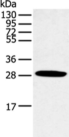 Gel: 12%SDS-PAGE Lysate: 40 microg Lane: Human normal lung tissue Primary antibody: TA367438 (CLDN25 Antibody) at dilution 1/250 Secondary antibody: Goat anti rabbit IgG at 1/8000 dilution Exposure time: 10 seconds