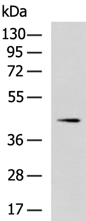 Gel: 8%SDS-PAGE Lysate: 40 microg Lane: HL60 cell lysate Primary antibody: TA367716 (SERPINB7 Antibody) at dilution 1/1000 Secondary antibody: Goat anti rabbit IgG at 1/5000 dilution Exposure time: 2 minutes