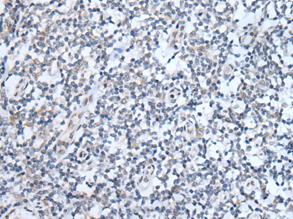 Immunohistochemistry of paraffin-embedded Human tonsil tissue using TA367723 (ABCA6 Antibody) at dilution 1/25 (Original magnification: x200)