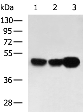 Gel: 8%SDS-PAGE Lysate: 40 microg Lane 1-3: Hela HUVEC A549 cell lysates Primary antibody: TA367737 (PLAG1 Antibody) at dilution 1/700 Secondary antibody: Goat anti rabbit IgG at 1/5000 dilution Exposure time: 30 seconds